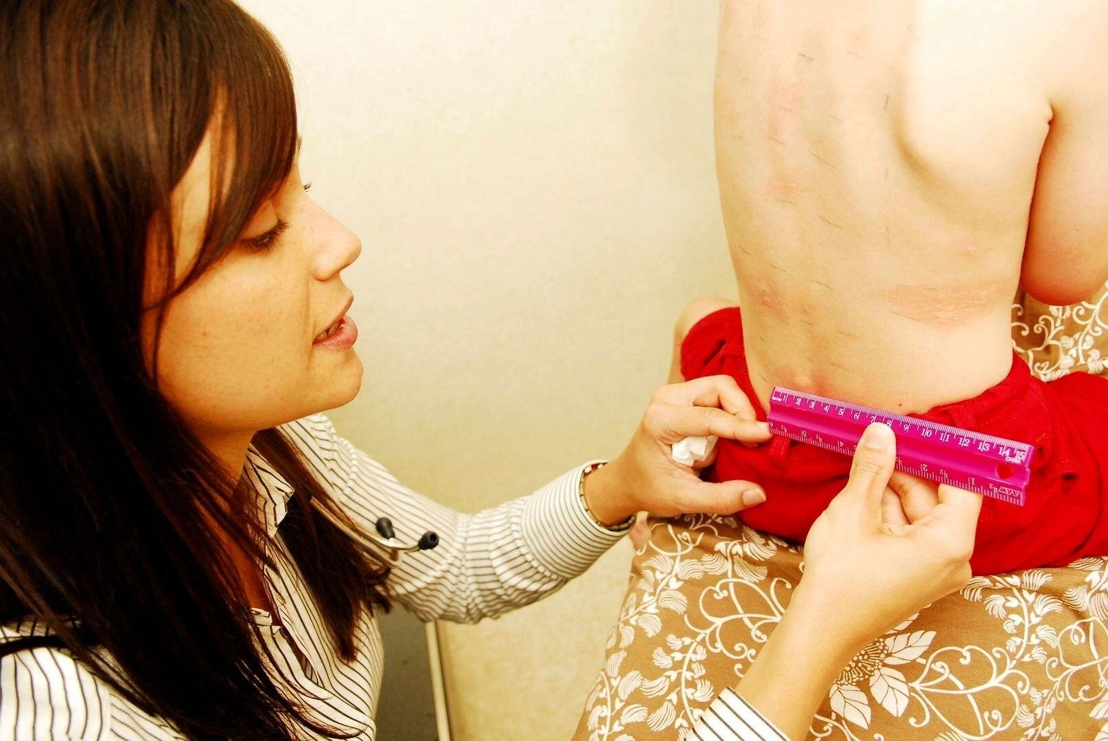 Allergy Testing